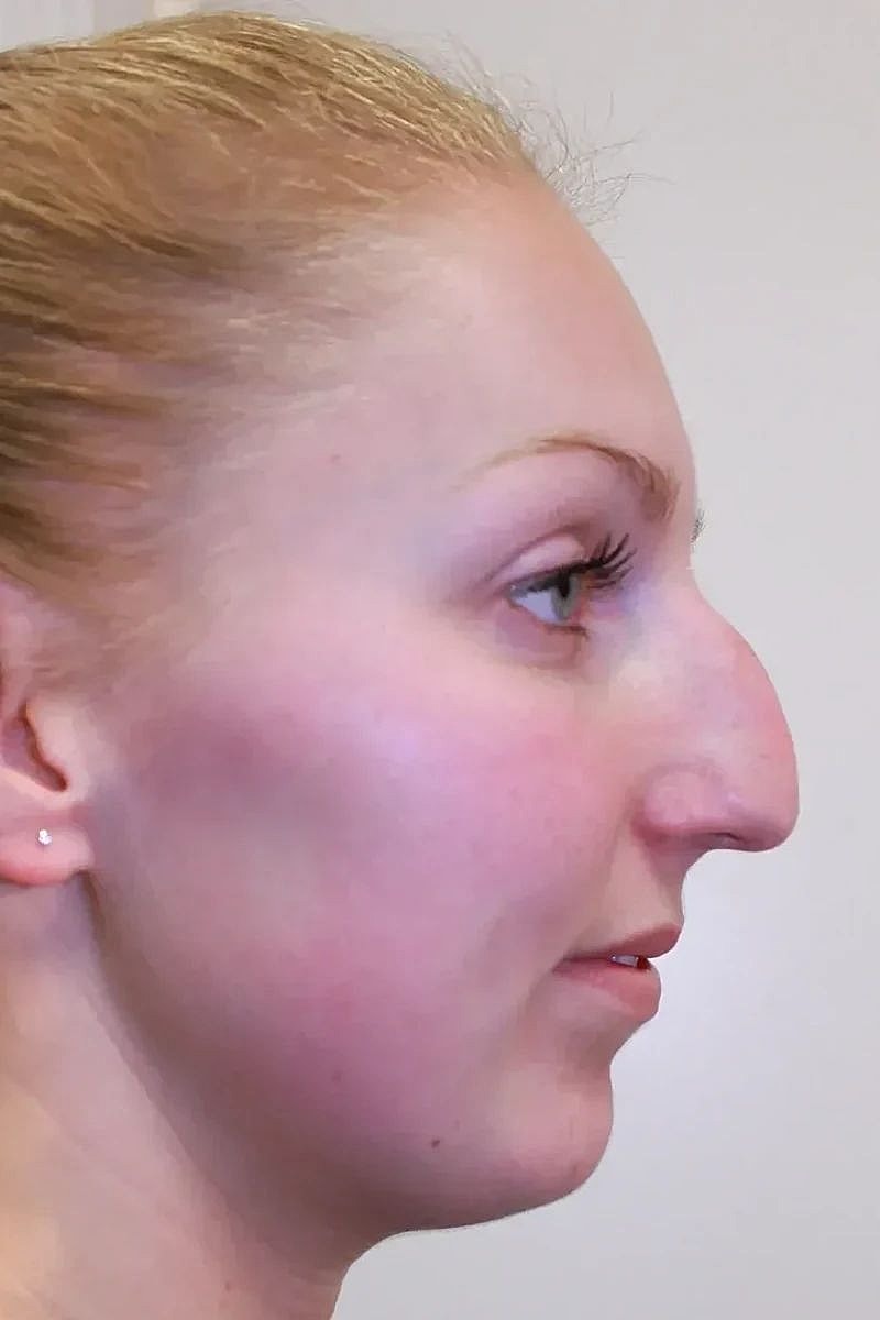 Profile view of a woman with light features.