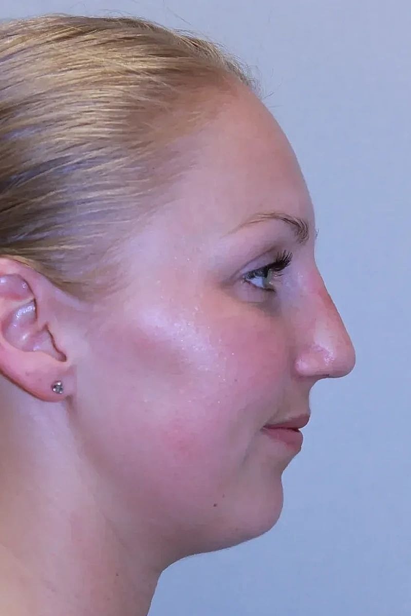 Profile view of a woman with blonde hair.