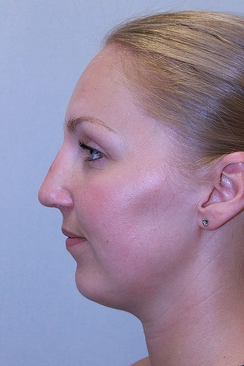 Profile view of a woman's face.
