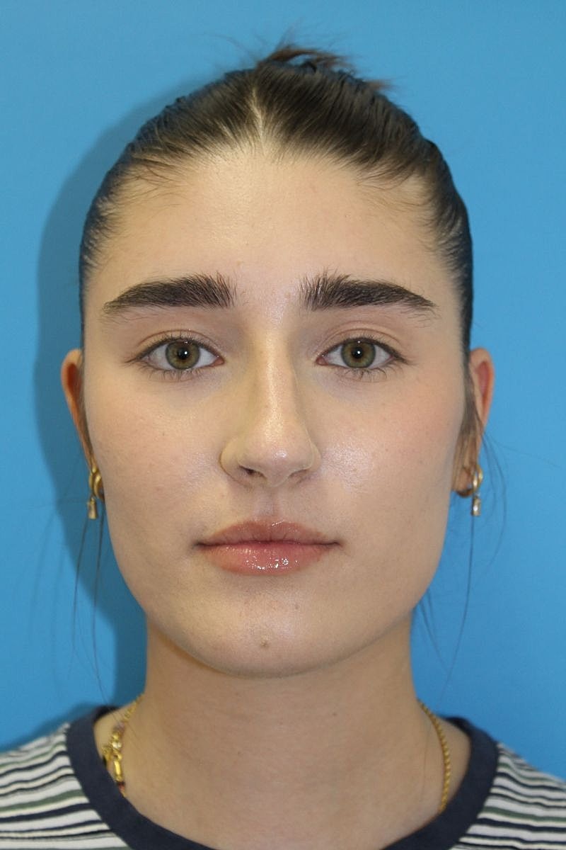 Portrait of a person with brown eyes.