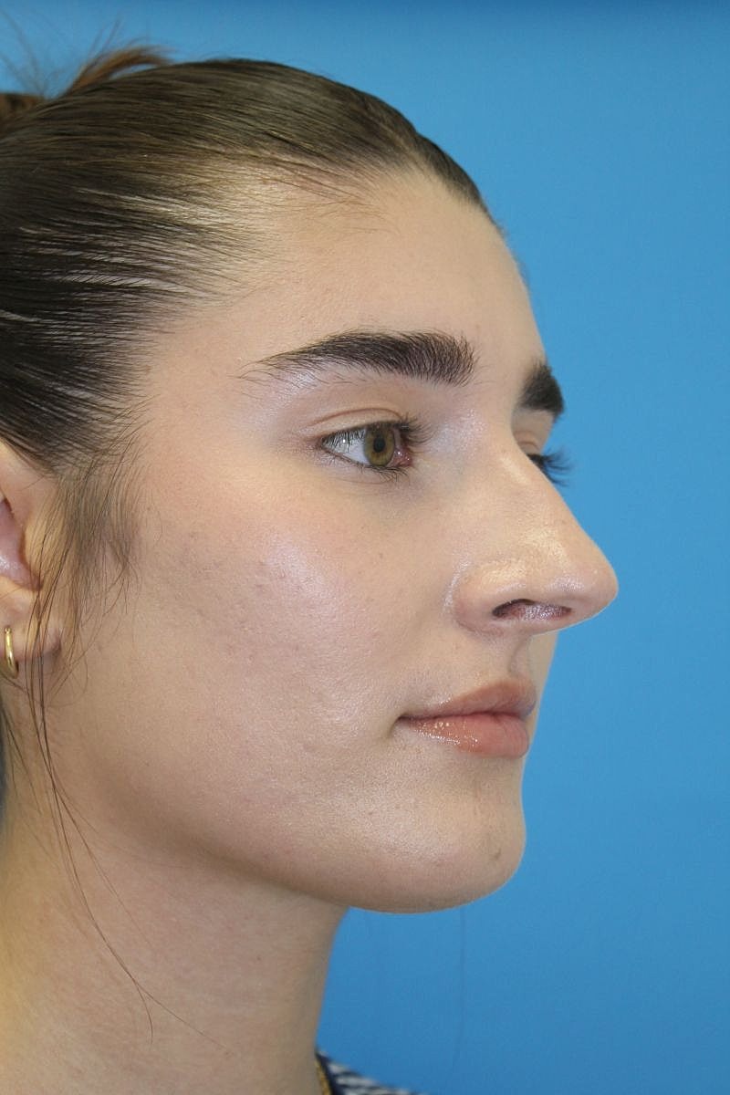 Profile of a woman against blue background.
