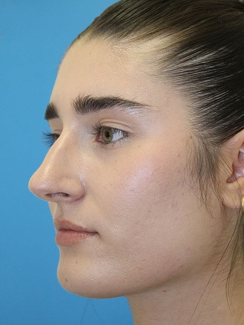 Profile view of a woman with smooth skin.