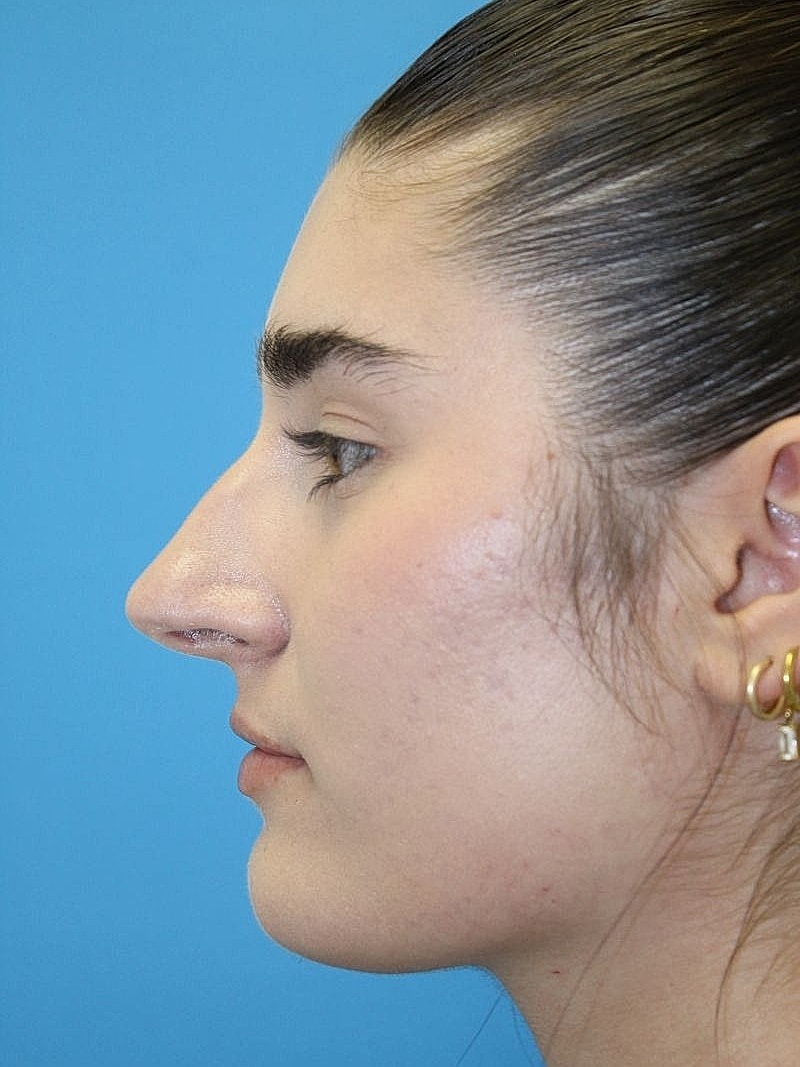 Profile view of person against blue background