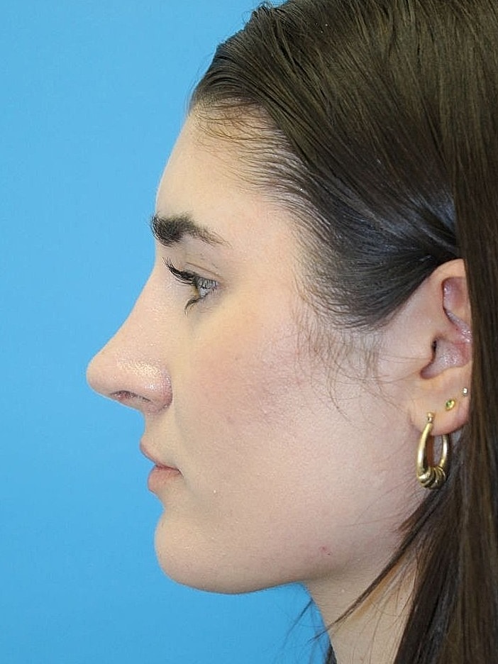 Profile view of a young woman with earrings.