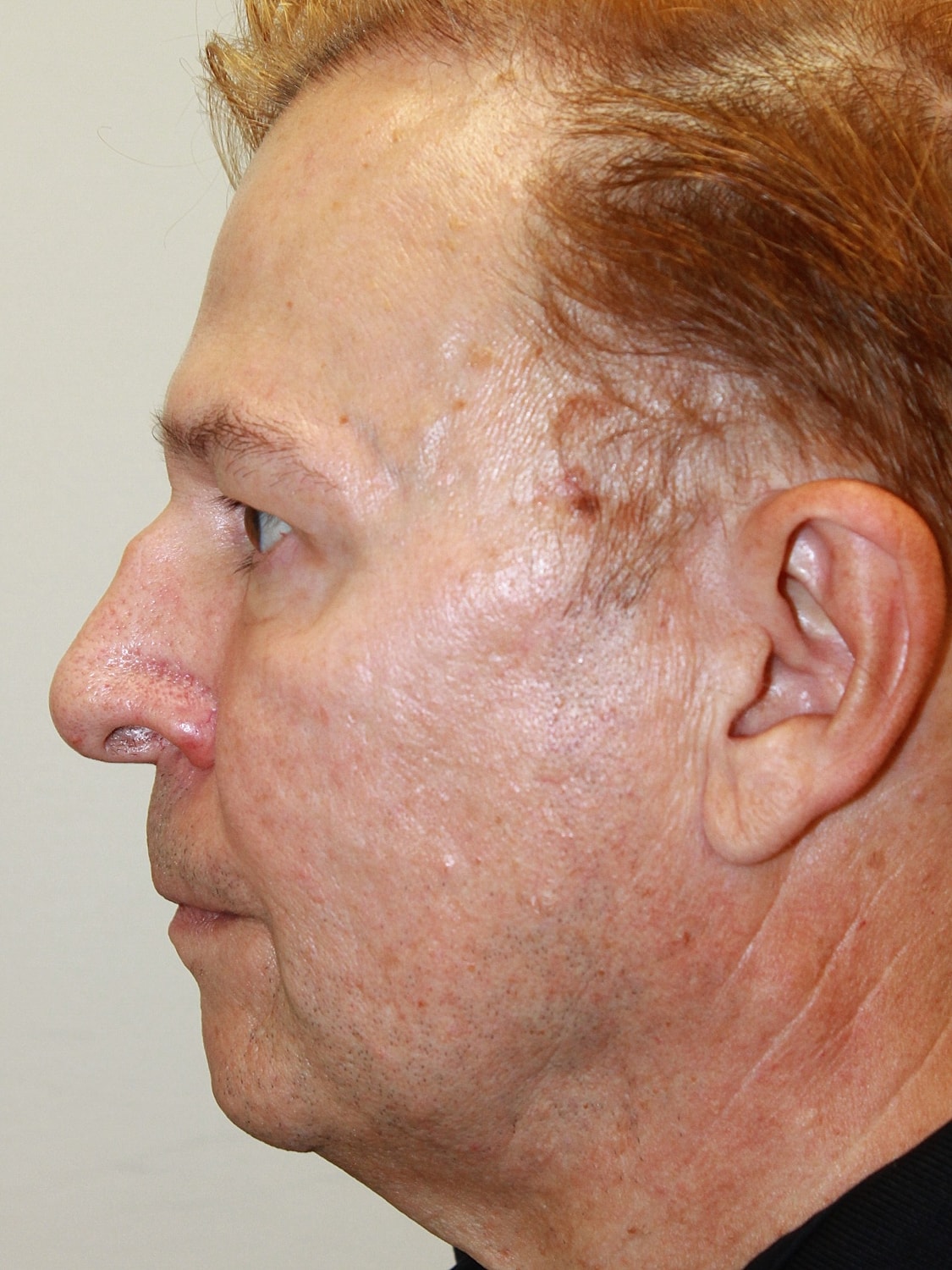 Profile view of a man with reddish hair.