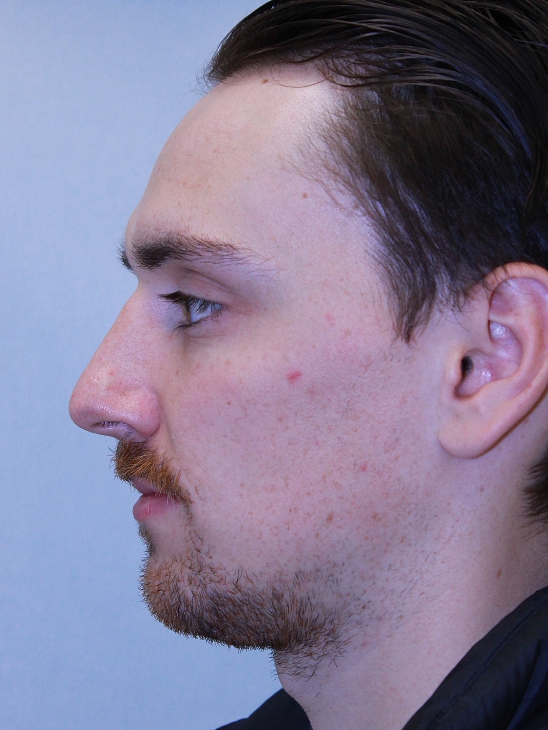 Profile view of a man with facial hair.
