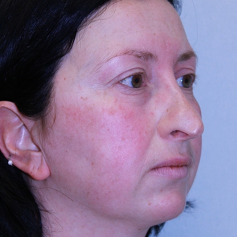 Profile of a woman with light skin tone.