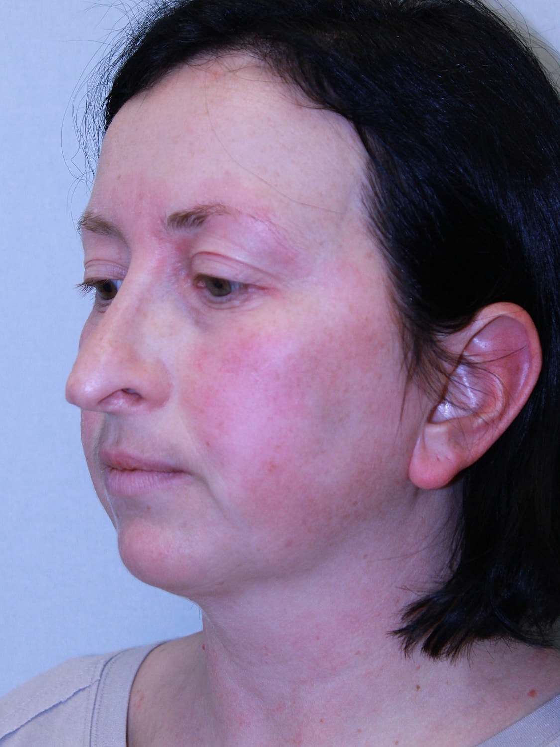 Profile view of a woman with fair skin.